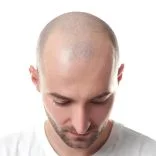 photo_5994654523147881419_y